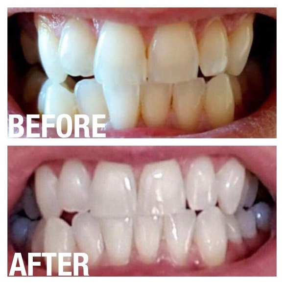 Whitening Toothpaste!! - Picture 6 of 6